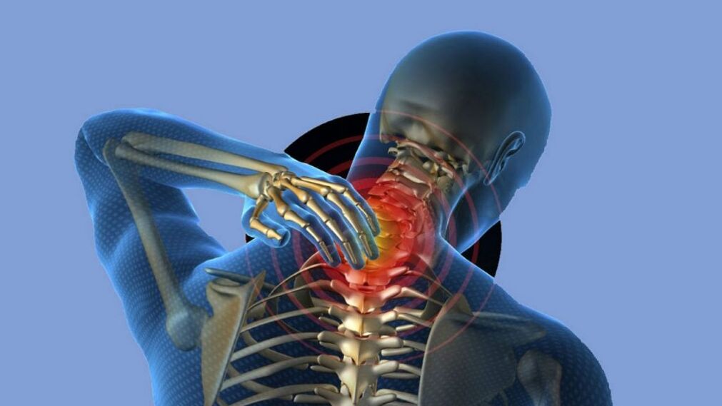 A méhnyakos régió osteochondrosis
