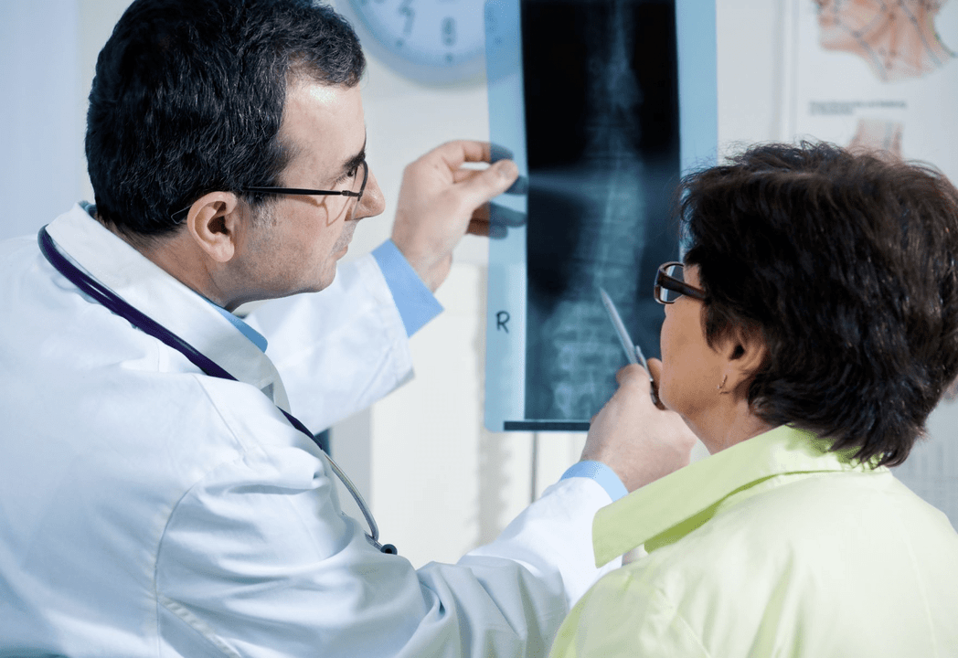 A neurológus a gerinc radiográfiájával diagnosztizálja az osteochondrosist