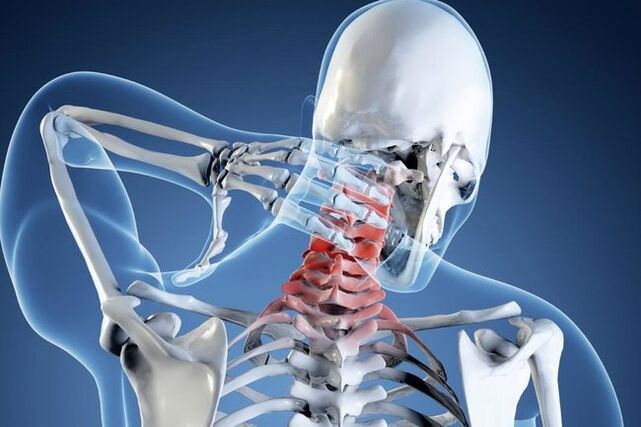 a nyaki gerinc osteochondrosisa